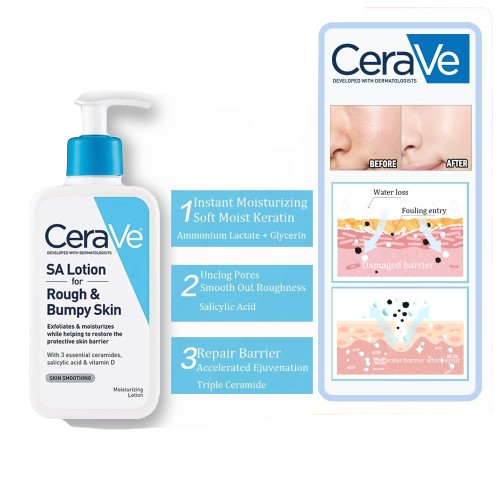 CeraVe SA Lotion for rough and bumpy skin with packaging and before-and-after diagram.